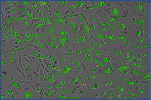 Fig 4: Expand the number of variables you can  analyze in your cell culture using brightfield, green,  and red fluorescent channels simultaneously.