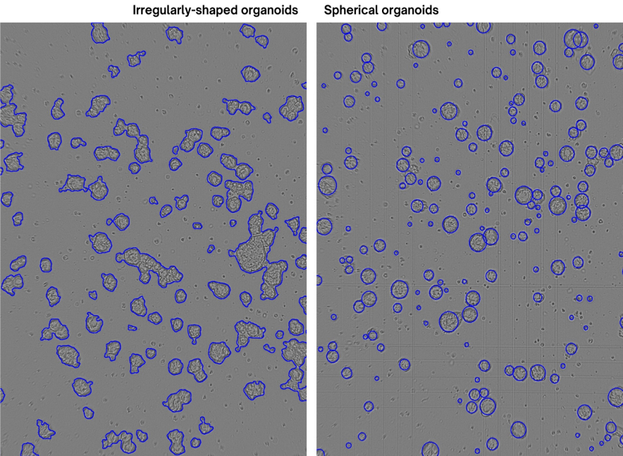 Figure 6. The newly updated Organoid Counting algorithm is designed to recognize and quantify not only irregularly-shaped  organoids (left), but also spherical organoids (right). In addition, the new algorithm is better at differentiating organoids from  cellular debris, thus reducing the amount of false positives/false negatives.