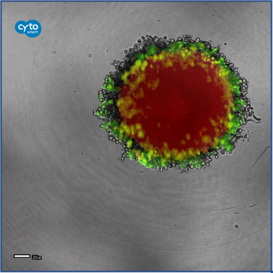 Fig 6: Proliferating cells in a 3D tumour spheroid as  indicated by green fluorescence. Red fluorescence  represents the drug infused in the tumour spheroid.  The drug uptake and its effect on proliferation of the  tumor cells are followed using the CytoSMART® Lux3  FL. 