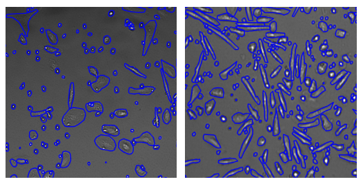 Representative images of M1 and M2 polarized cells obtained with the CytoSMART Lux2 Duo Kit